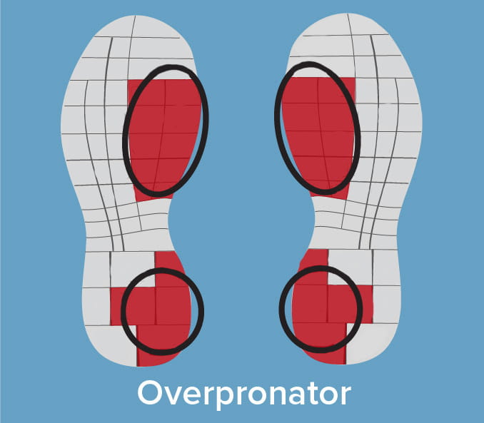 overpronation heel wear