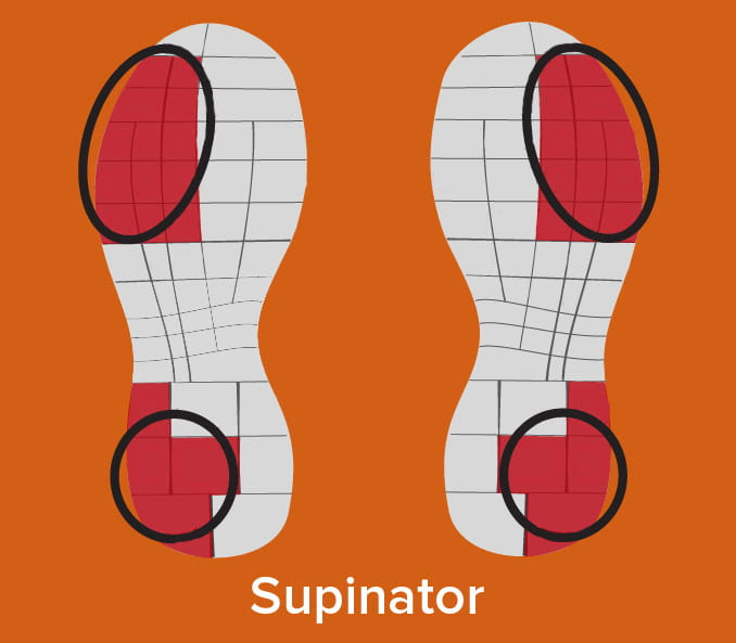 supination wear on shoes