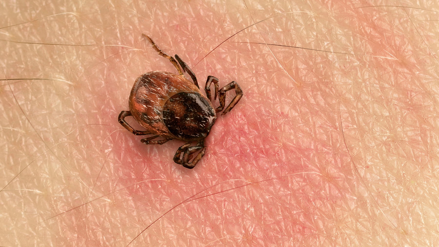  Can A Tick Bite Make A Dog Sick 