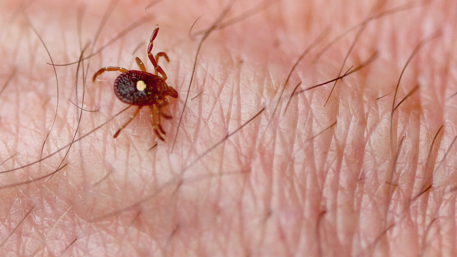 Tick That Causes Meat Allergy Is Spreading   Tickthatcausesmeatallergy Large 