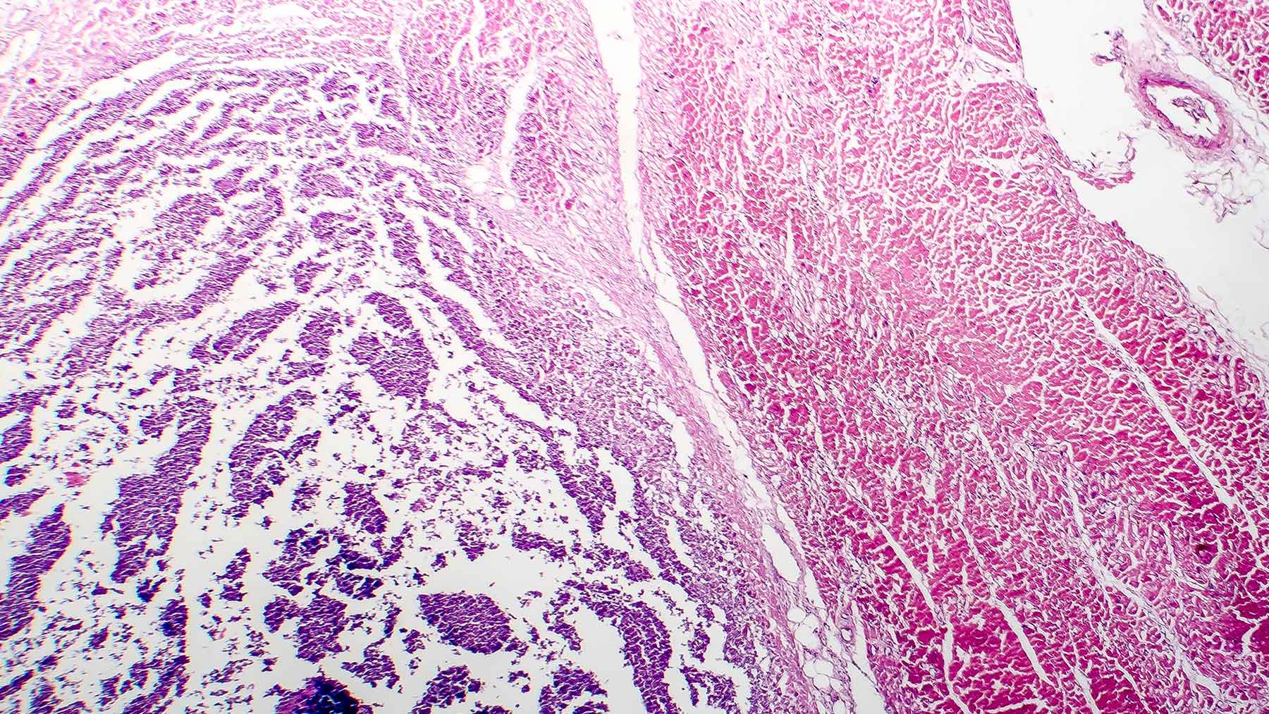 Inflammation_large