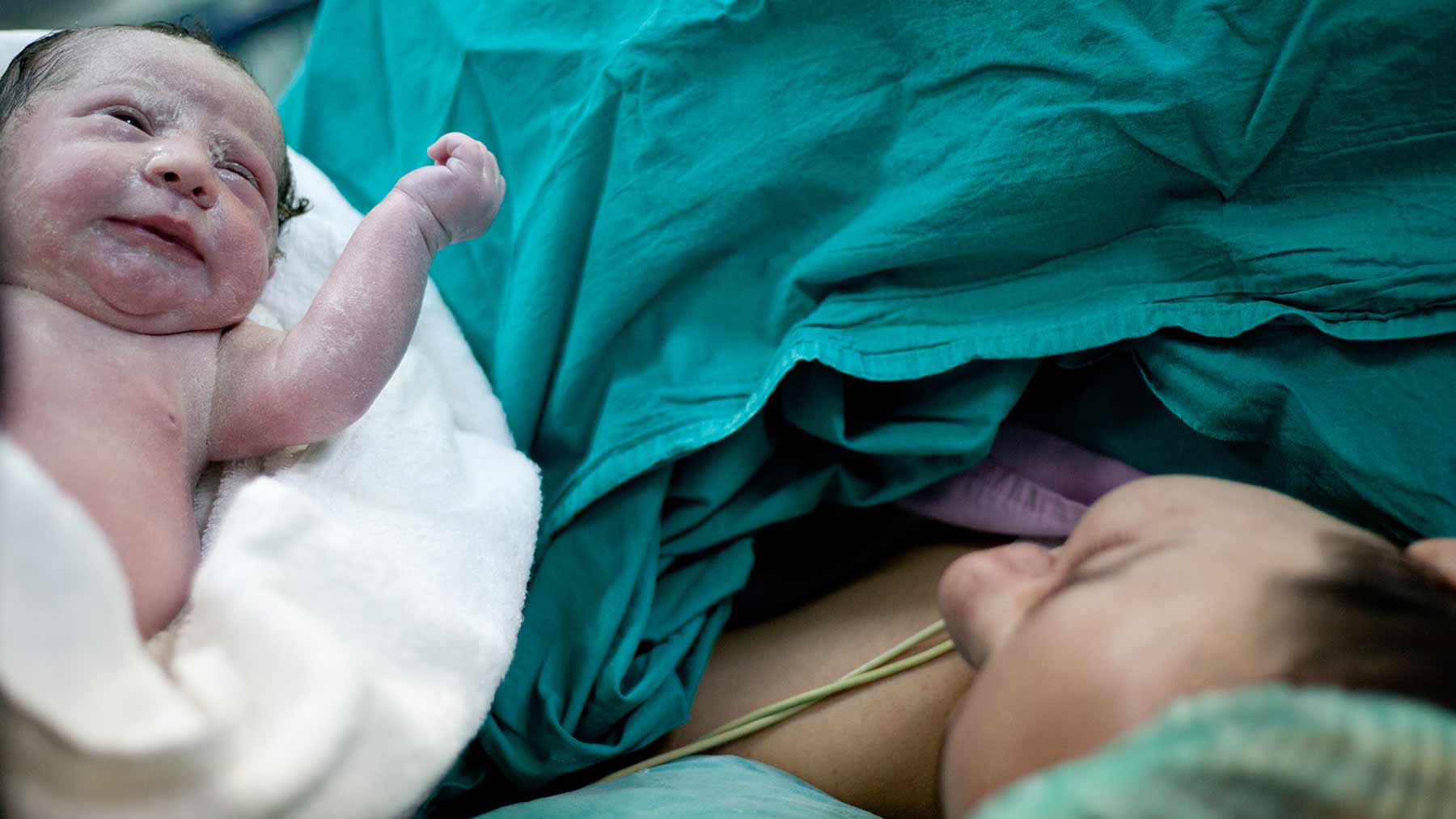 All about C-sections: Before, during and after