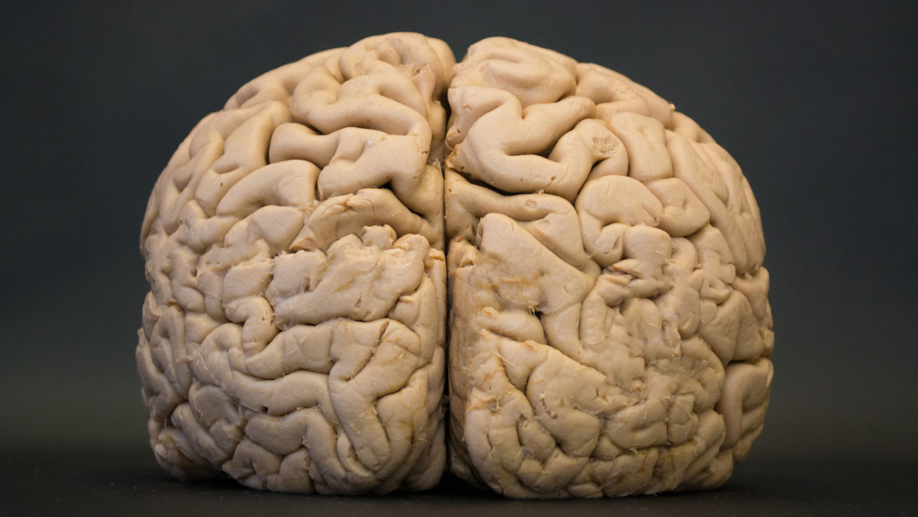 Highest-Resolution Human Brain 'Parts List' To Date Lays Road Map