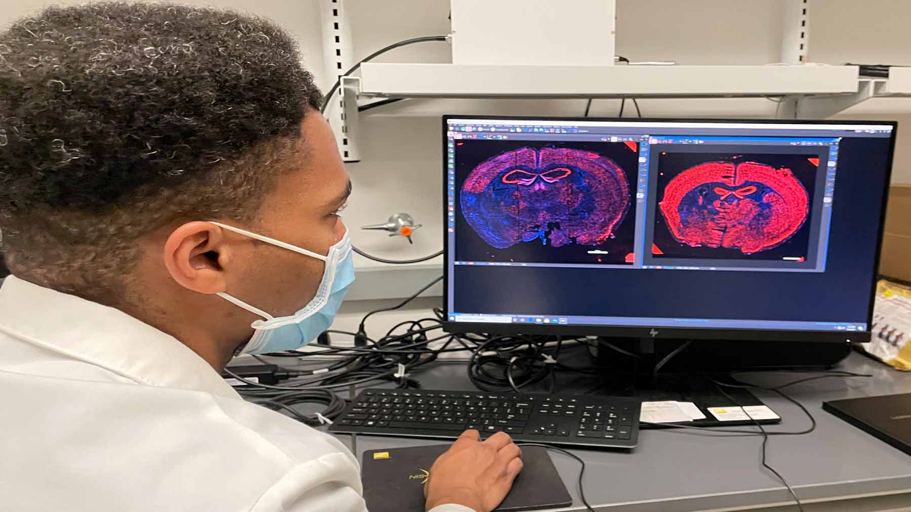 researcher looks at brain scans of mice with a stroke