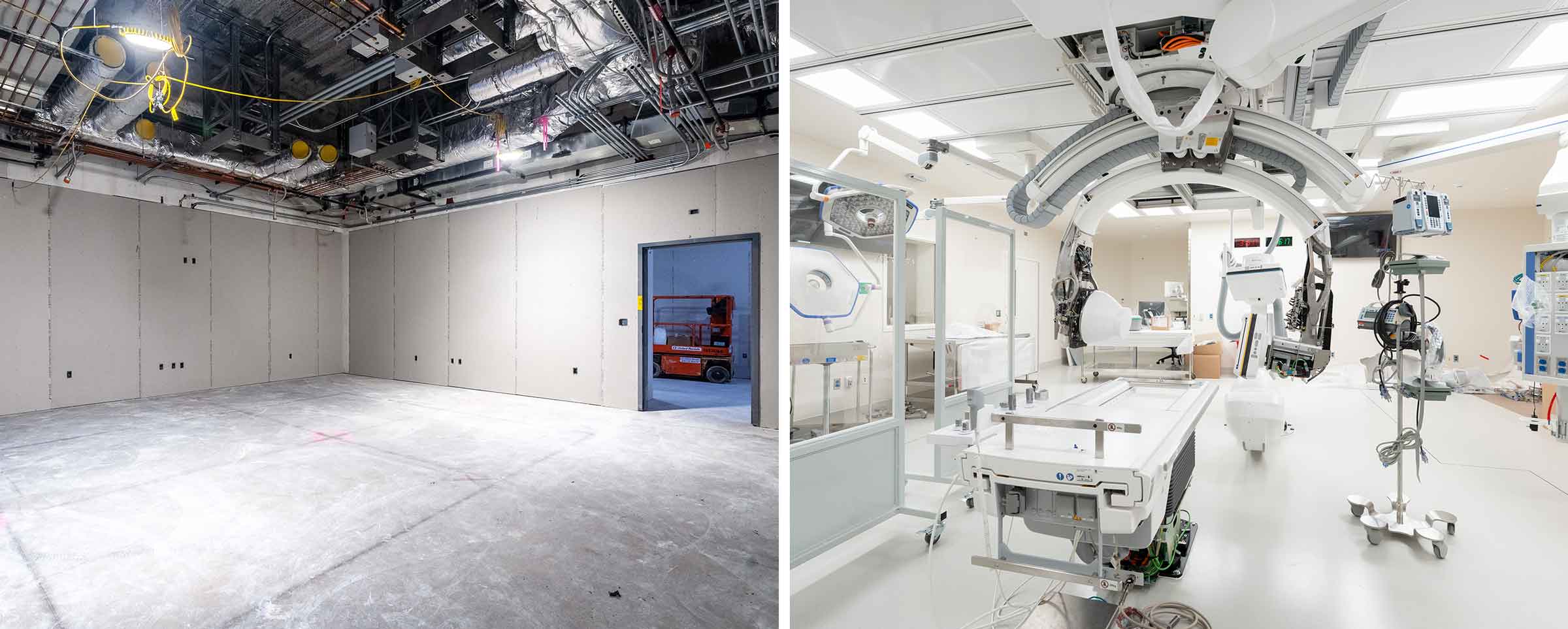 before and after image of an operating room in the new University Hospital at The Ohio State University Wexner Medical Center