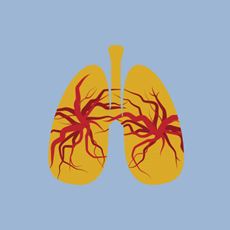 Lung icon depicting interstitial lung disease