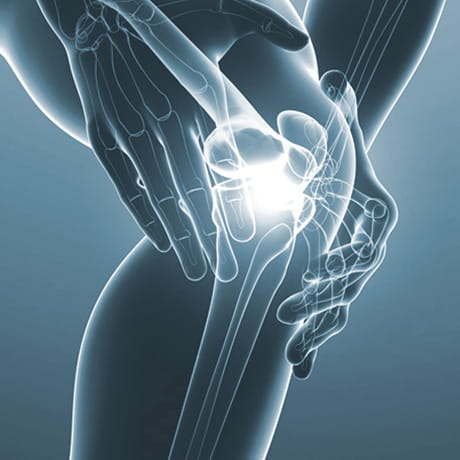 Knee bones with joint pain