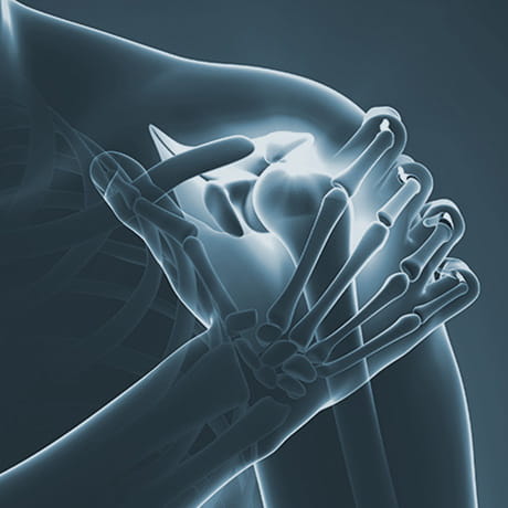 Bones of the shoulder with joint pain