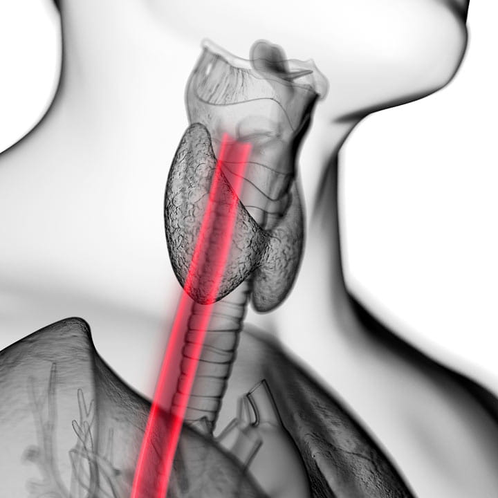 Esophageal-diagram