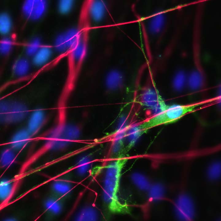 Myelinating oligodendrocyte (GFP, green) reaching out to wrap and contact an axon (NF, red) grown in culture