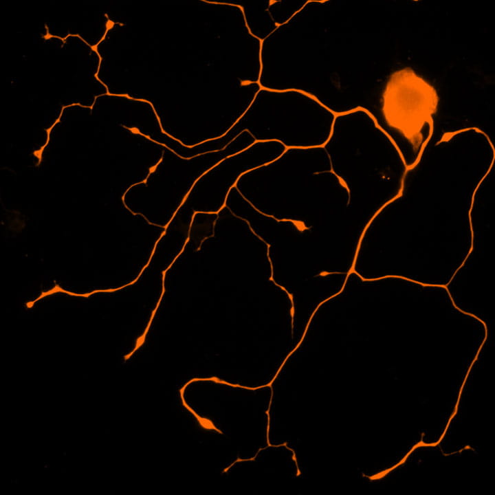 In vitro–cultured sensory neurons