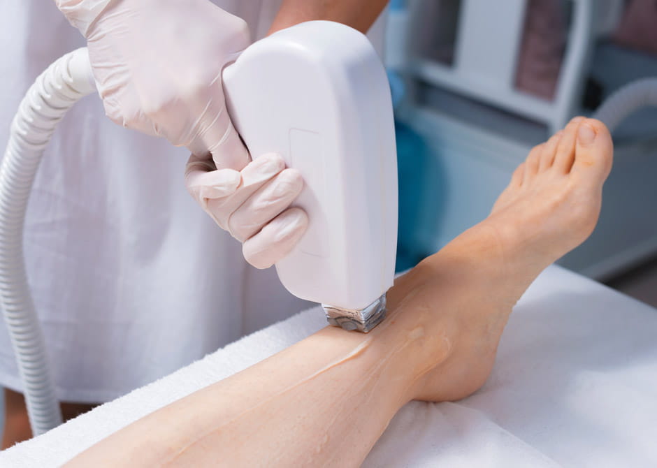 woman receiving laser hair removal on her leg