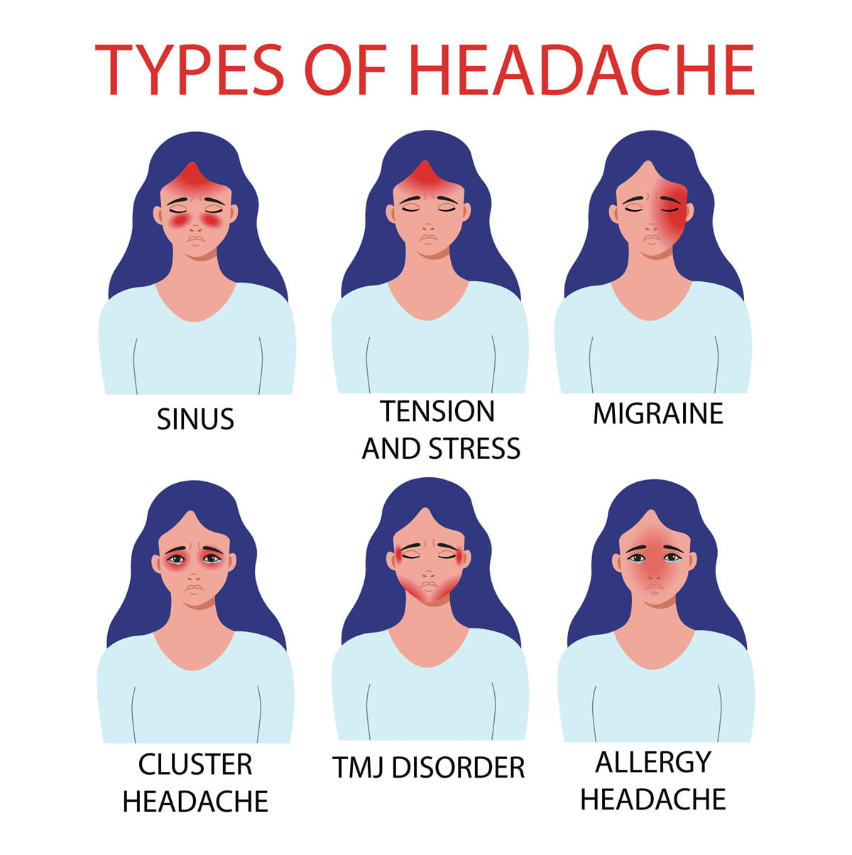 Types Of Headaches graphic- sinus, tension/stress, migraine, cluster, allergy, TMJ