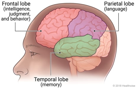 What's happening in the parts of the brain during Frontotemporal Dementia?