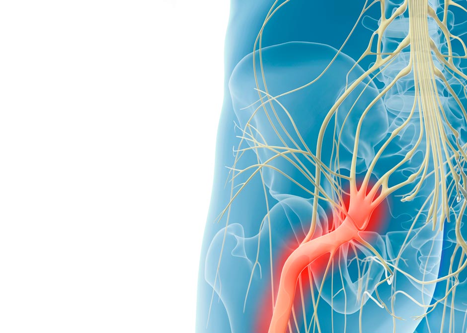 sciatic nerve diagram