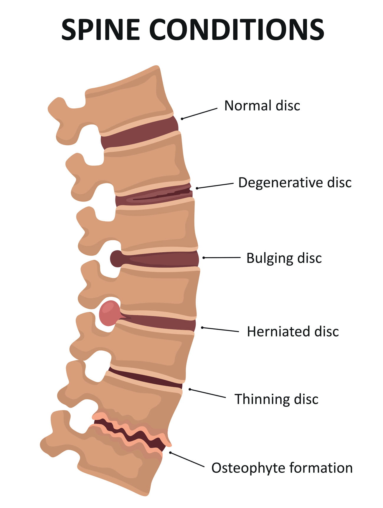 An illustration of a spine and its parts