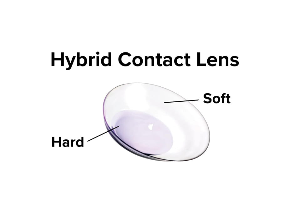 Hybrid Contact Lens