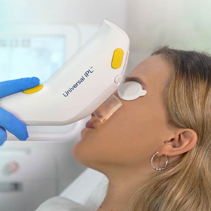 Woman with blond hair in exam room with Universal IPL device held to face