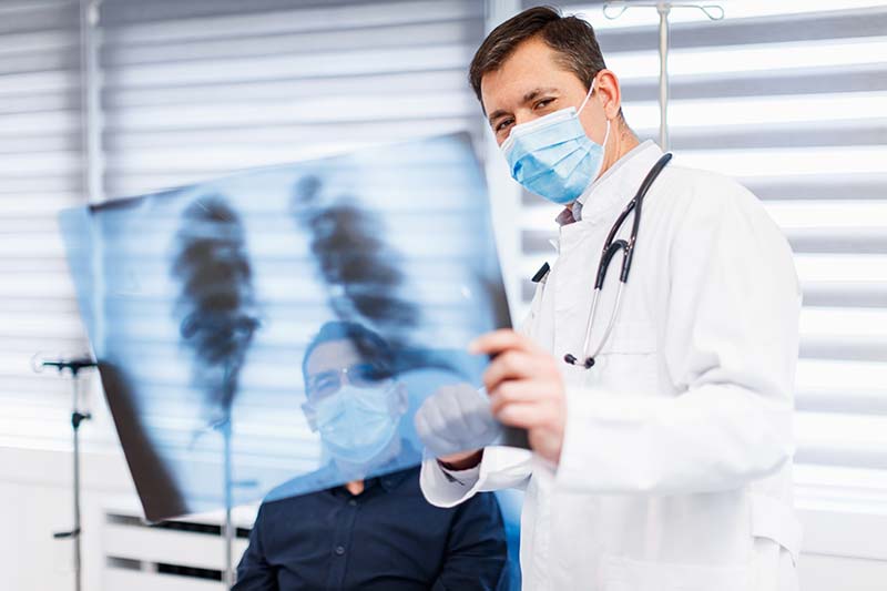 Doctor holding lung x-ray