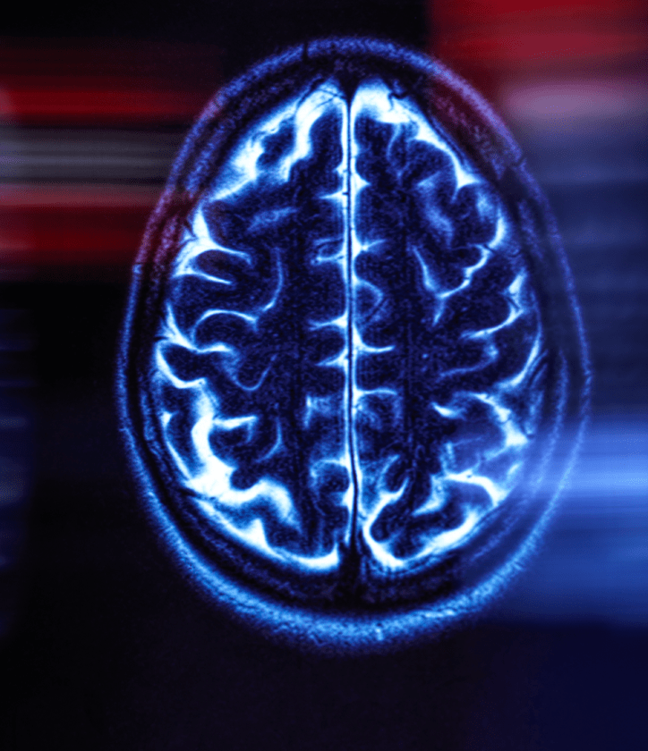 neuro brain scan