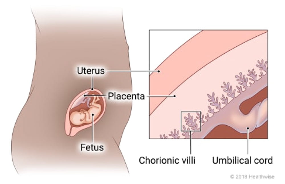 Illustration of chorionic villus sampling