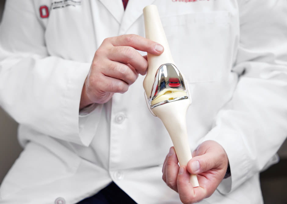 Knee model Replacement Detail