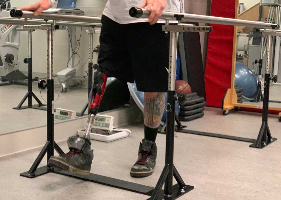 man with prosthetic leg doing physical therapy