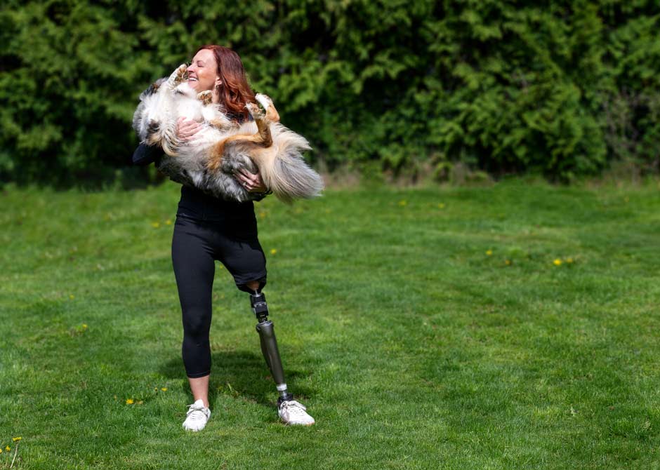 patient Stacey Finley with prosthetic leg holding pet dog