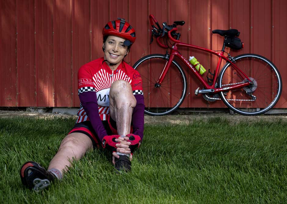 limb restoration patient Mary Applegate